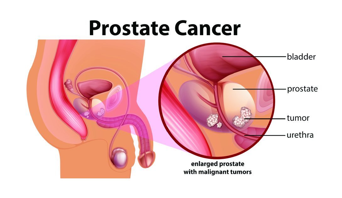 Top robotic surgeon in Kolkata